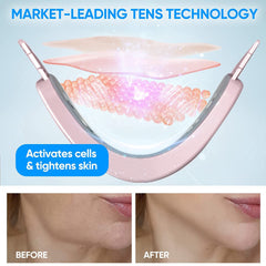 Smart Double Chin Face Lift Device with Magnetic Massage